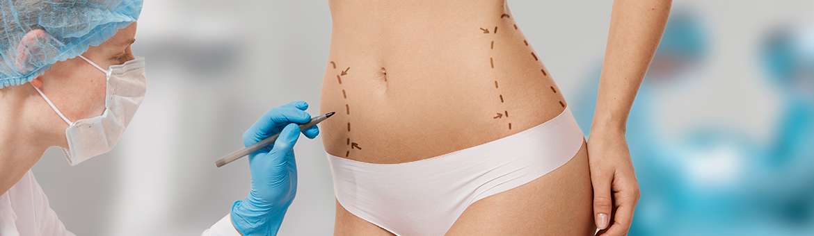 Пластика живота (абдомінопластика)