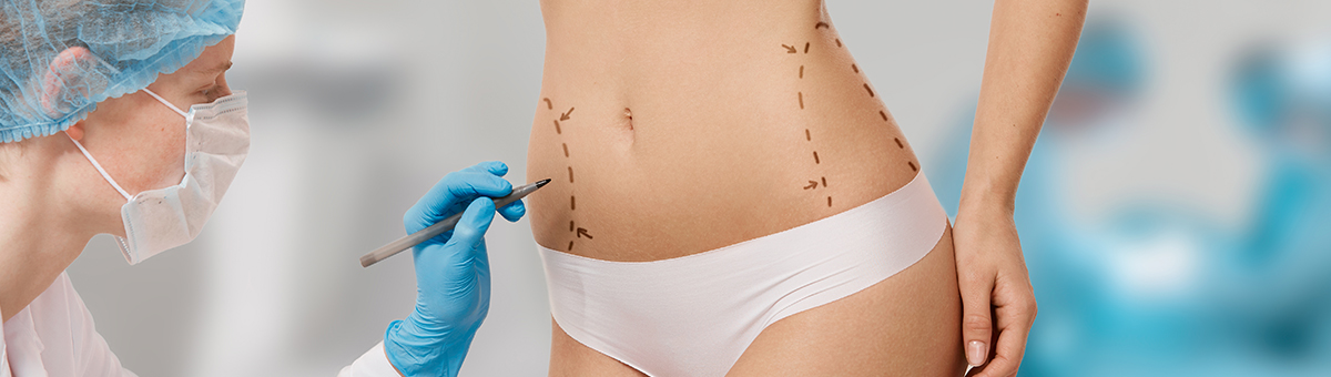 Пластика живота (абдомінопластика)