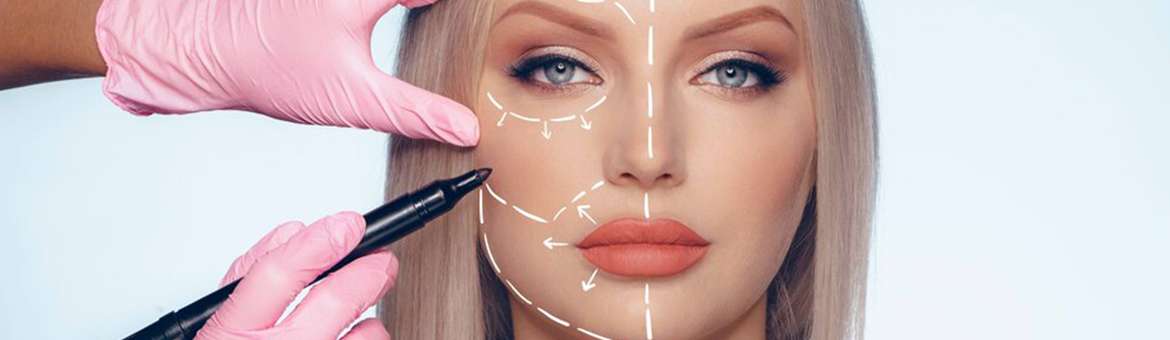 Підтяжка обличчя (фейсліфтинг)