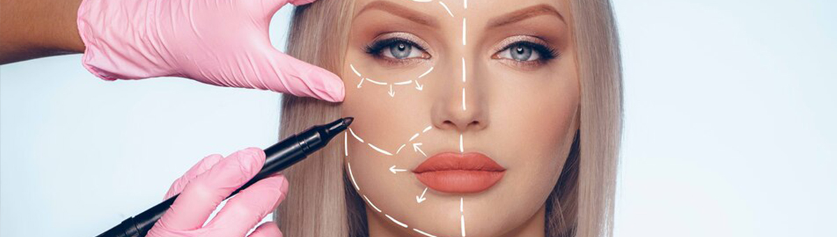 Підтяжка обличчя (фейсліфтинг)