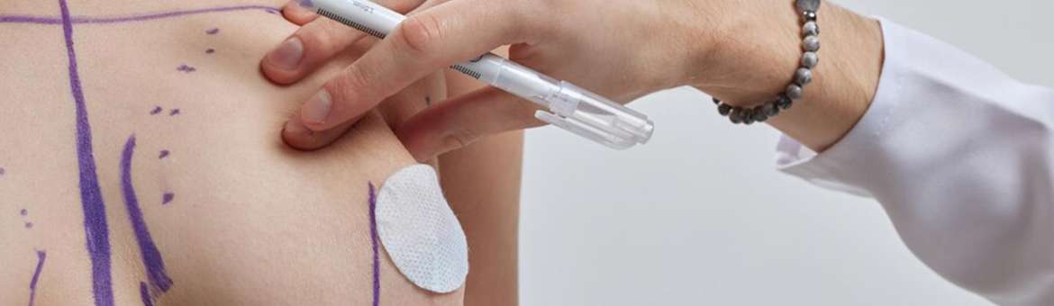 Підтяжка грудей (мастопексія)