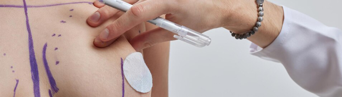 Підтяжка грудей (мастопексія)